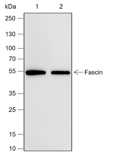 Anti-Fascin Rabbit mAb