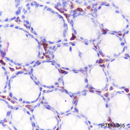 Anti-Fascin Rabbit mAb