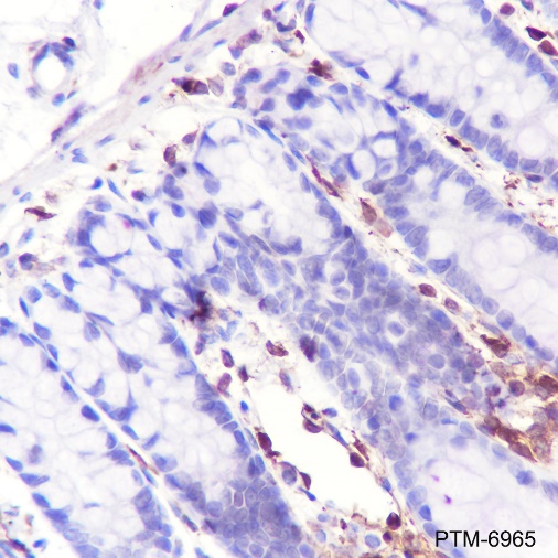 Anti-Fascin Rabbit mAb