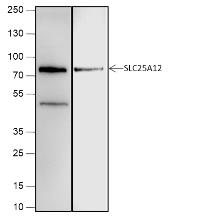 Anti-SLC25A12 Rabbit mAb