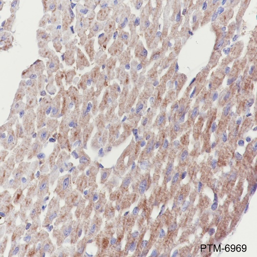 Anti-SLC25A12 Rabbit mAb