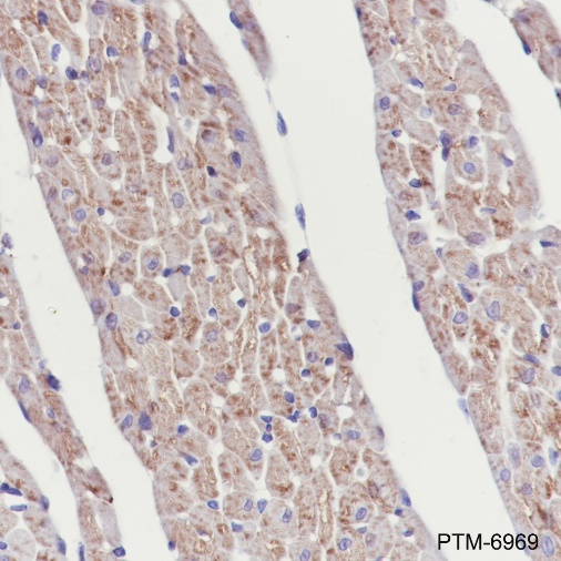 Anti-SLC25A12 Rabbit mAb
