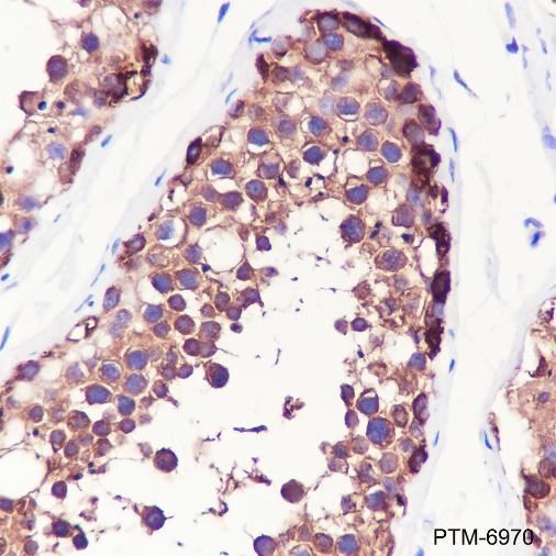 Anti-HSP90 beta Rabbit pAb