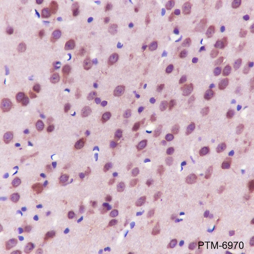 Anti-HSP90 beta Rabbit pAb