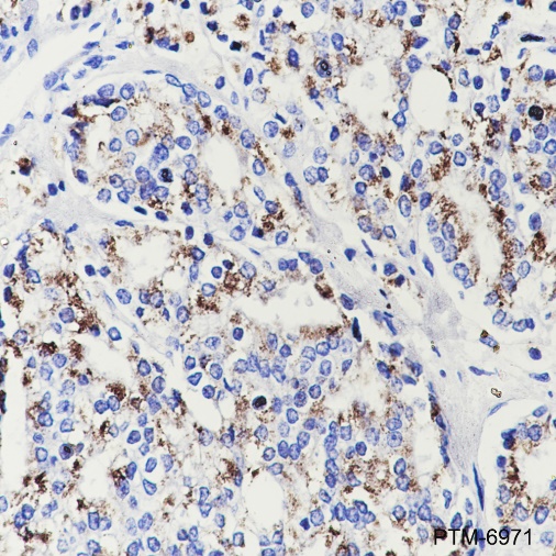 Anti-SLC45A3 Rabbit mAb