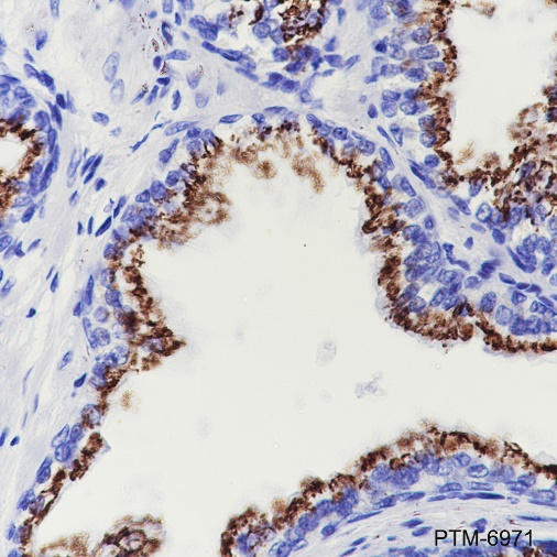 Anti-SLC45A3 Rabbit mAb