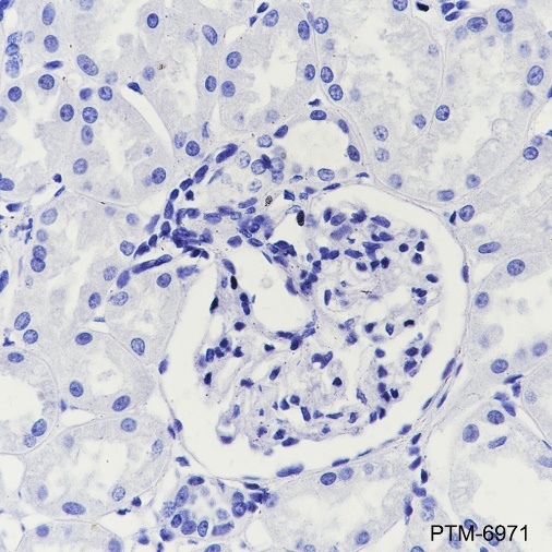 Anti-SLC45A3 Rabbit mAb