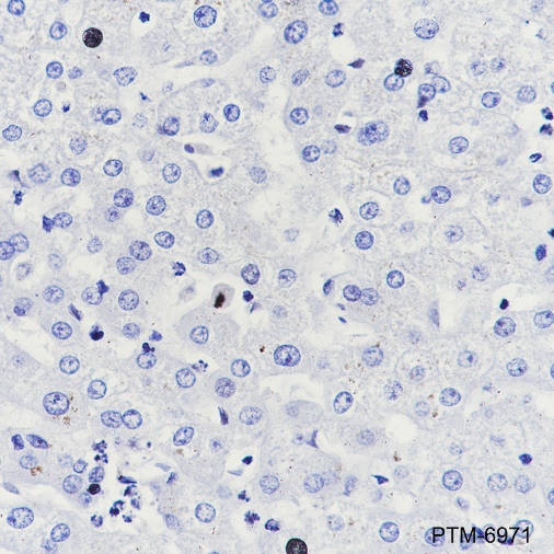 Anti-SLC45A3 Rabbit mAb