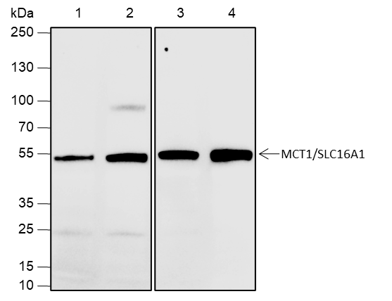 Anti-SLC16A1 Rabbit mAb