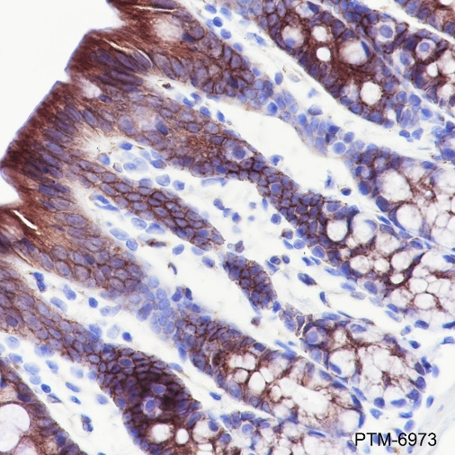 Anti-SLC16A1 Rabbit mAb