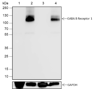 Anti-GABA B Receptor 1 Rabbit mAb