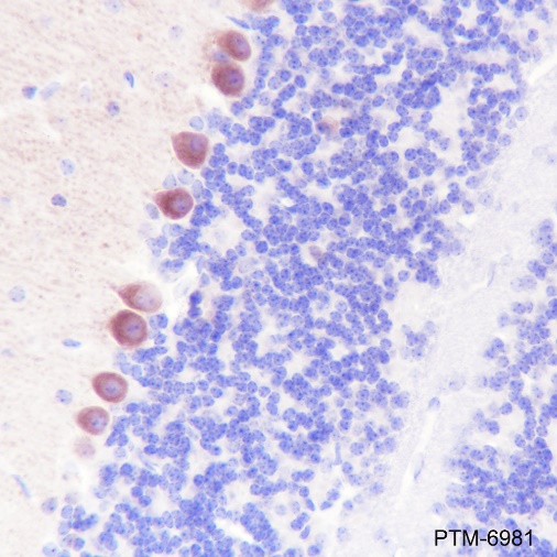 Anti-GABA B Receptor 1 Rabbit mAb