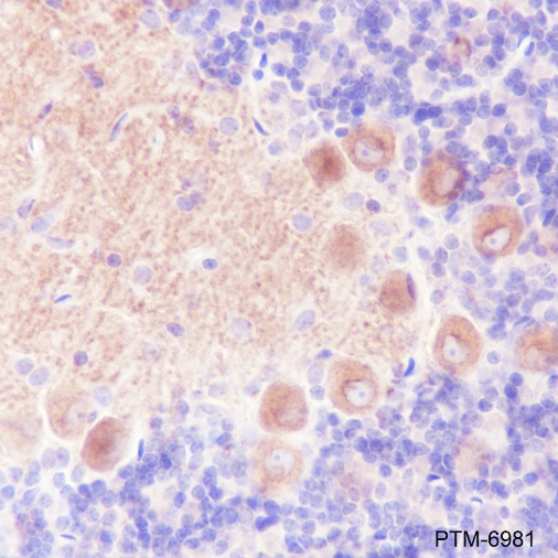 Anti-GABA B Receptor 1 Rabbit mAb