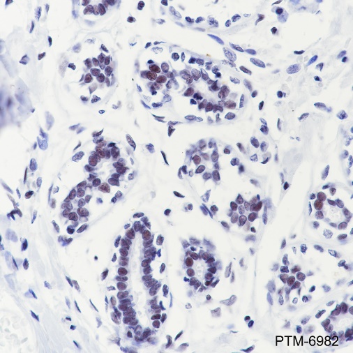 Anti-CHD4 Rabbit mAb