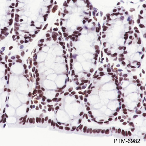 Anti-CHD4 Rabbit mAb