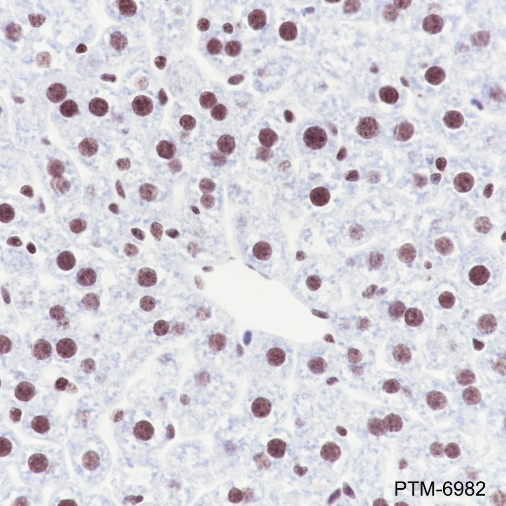 Anti-CHD4 Rabbit mAb