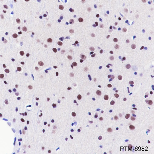 Anti-CHD4 Rabbit mAb
