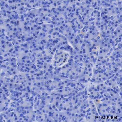 Anti-GATA1 Rabbit mAb