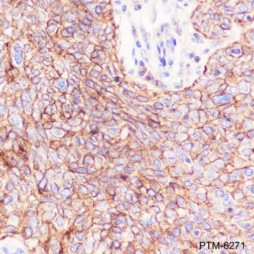 Anti-Na+/K+ ATPase alpha-1 Rabbit mAb