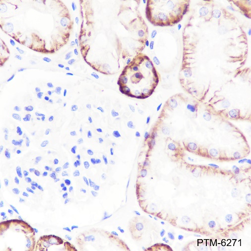 Anti-Na+/K+ ATPase alpha-1 Rabbit mAb