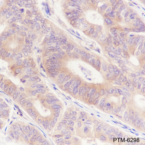 Anti-CRMP2 Rabbit mAb
