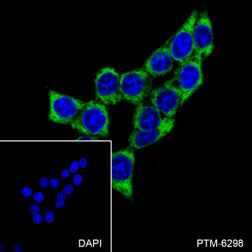 Anti-CRMP2 Rabbit mAb