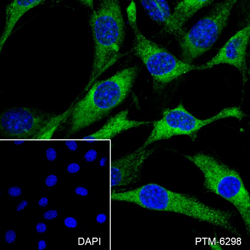 Anti-CRMP2 Rabbit mAb