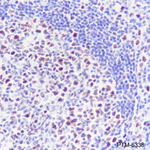 Anti-p60 CAF1 / MPP7 Rabbit mAb