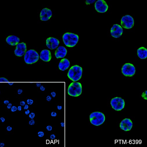 Anti-CD8 alpha Rabbit mAb