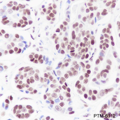 Anti-SETD1A Rabbit mAb