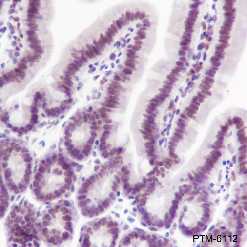Anti-SETD1A Rabbit mAb