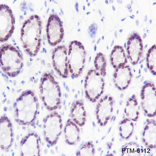 Anti-SETD1A Rabbit mAb