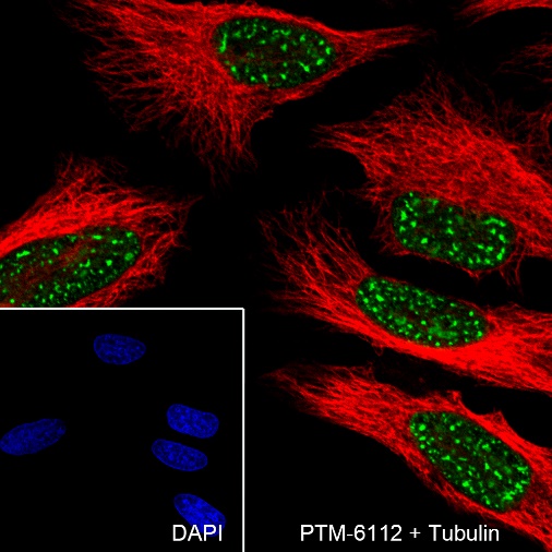 Anti-SETD1A Rabbit mAb
