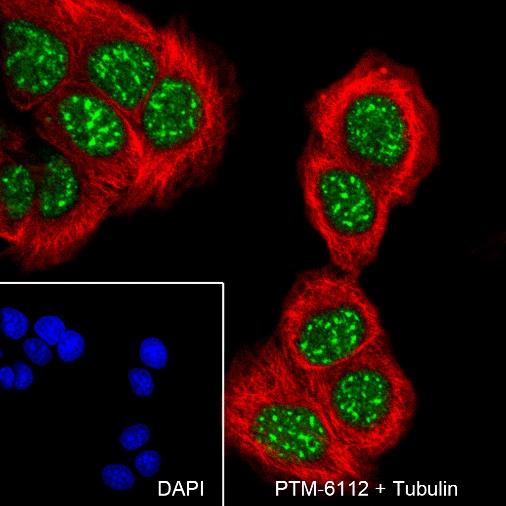Anti-SETD1A Rabbit mAb