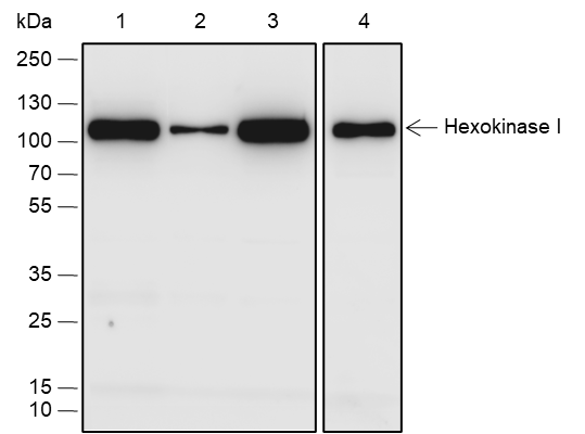 Anti-Hexokinase I Rabbit pAb