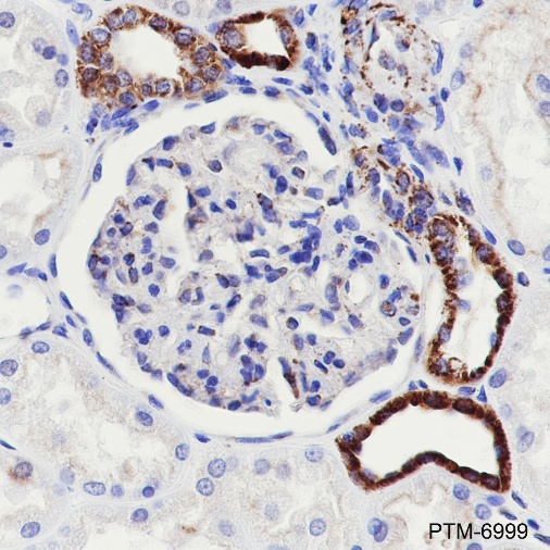 Anti-Hexokinase I Rabbit pAb