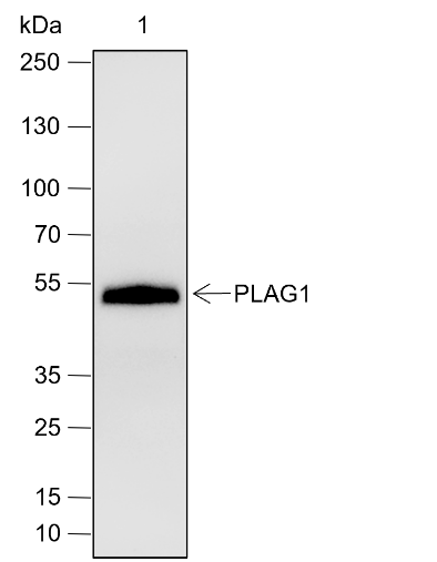 Anti-PLAG1 Rabbit mAb