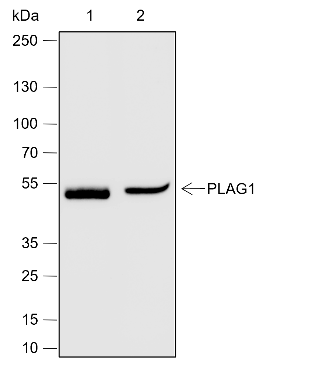 Anti-PLAG1 Rabbit mAb
