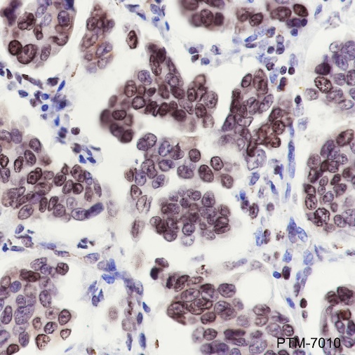 Anti-PLAG1 Rabbit mAb