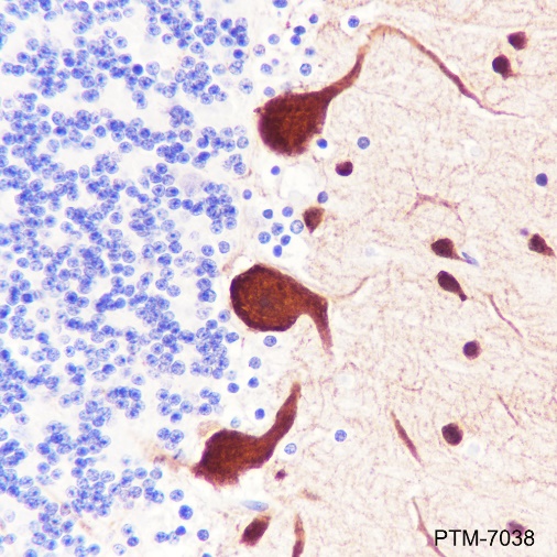 Anti-Parvalbumin Rabbit mAb