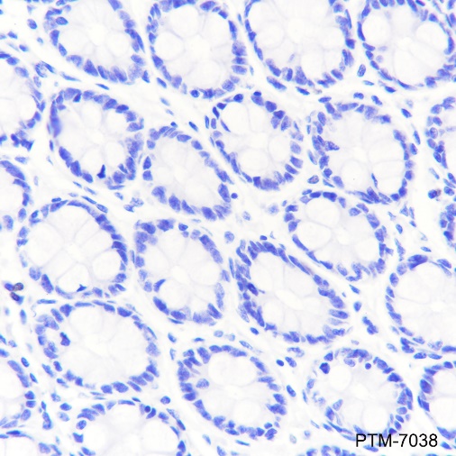 Anti-Parvalbumin Rabbit mAb