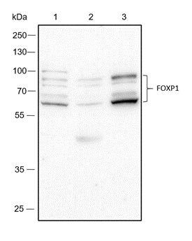 Anti-FOXP1 Rabbit mAb