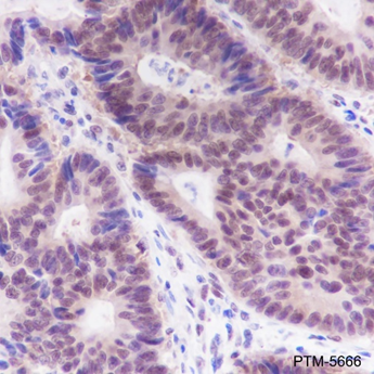Anti-FOXP1 Rabbit mAb