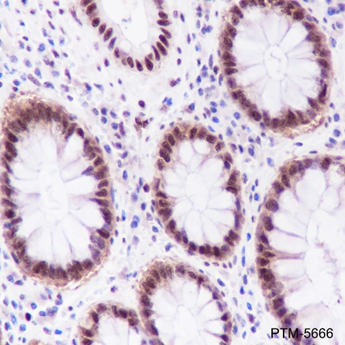 Anti-FOXP1 Rabbit mAb