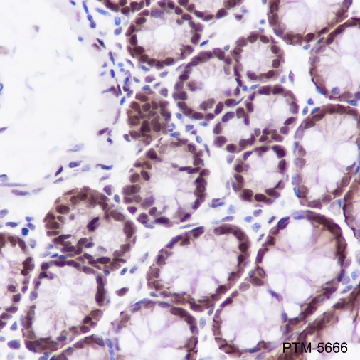 Anti-FOXP1 Rabbit mAb