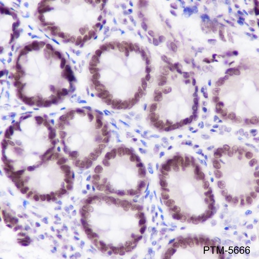 Anti-FOXP1 Rabbit mAb