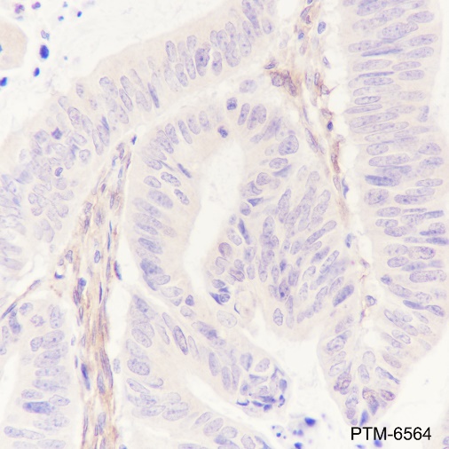 Anti-PDGFR beta Rabbit pAb