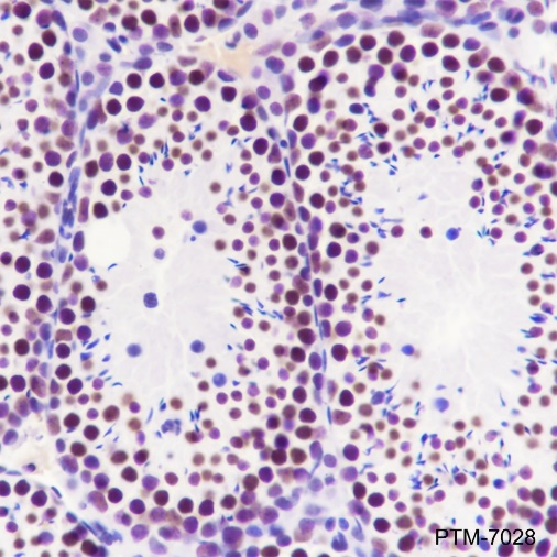Anti-METTL3 Mouse mAb