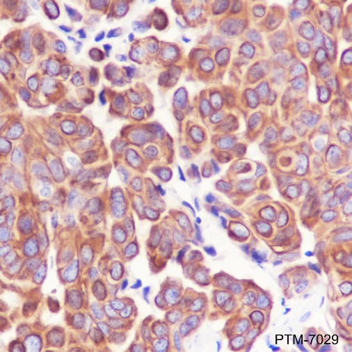 Anti-TGF beta 2 Mouse mAb