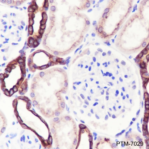 Anti-TGF beta 2 Mouse mAb